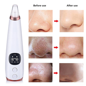 Black Head Remover Vacuum